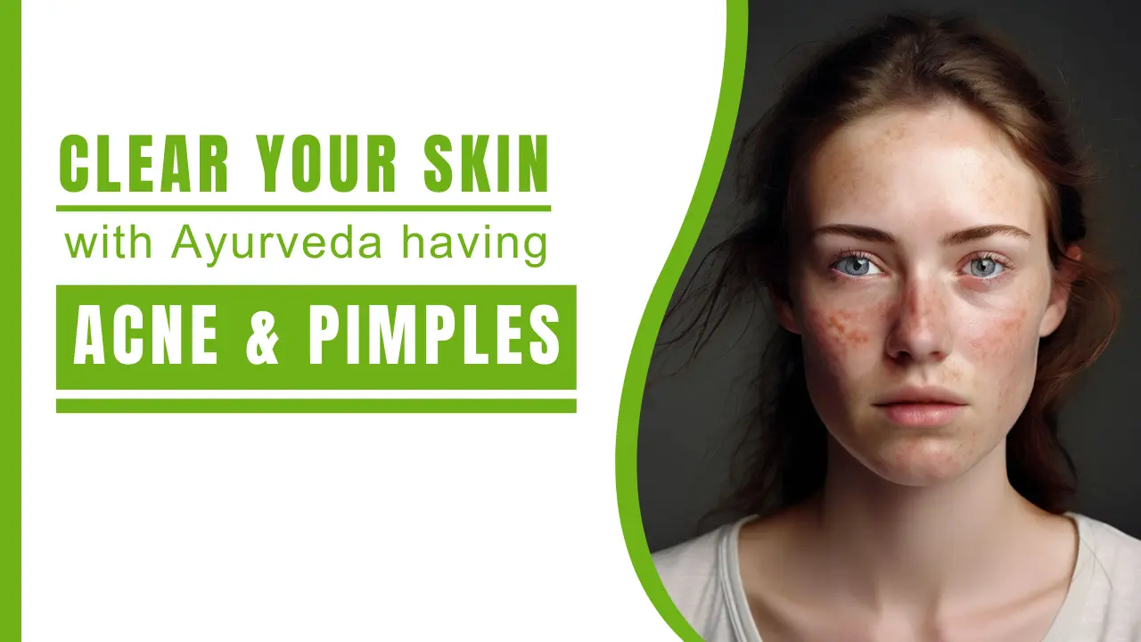 Clear Your Skin with Ayurvedic Solutions for Acne and Pimples