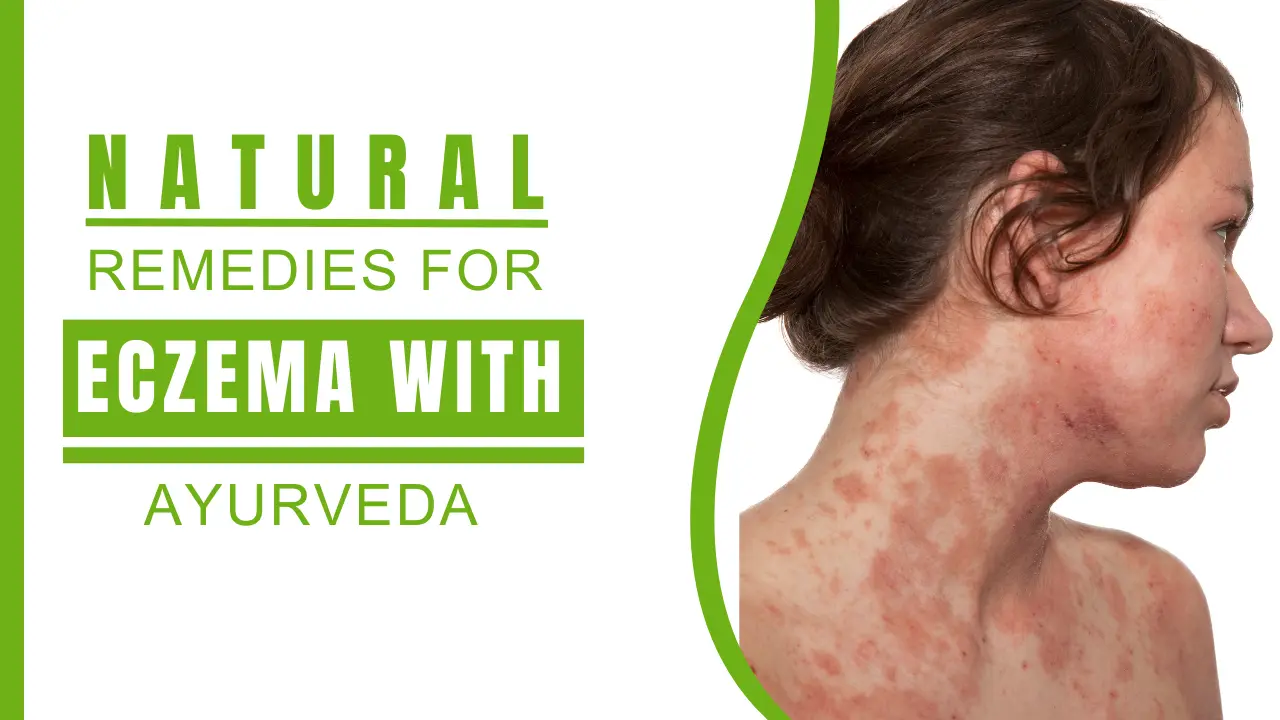 Natural Remedies for Eczema with Ayurveda by Nirogi Healthcare