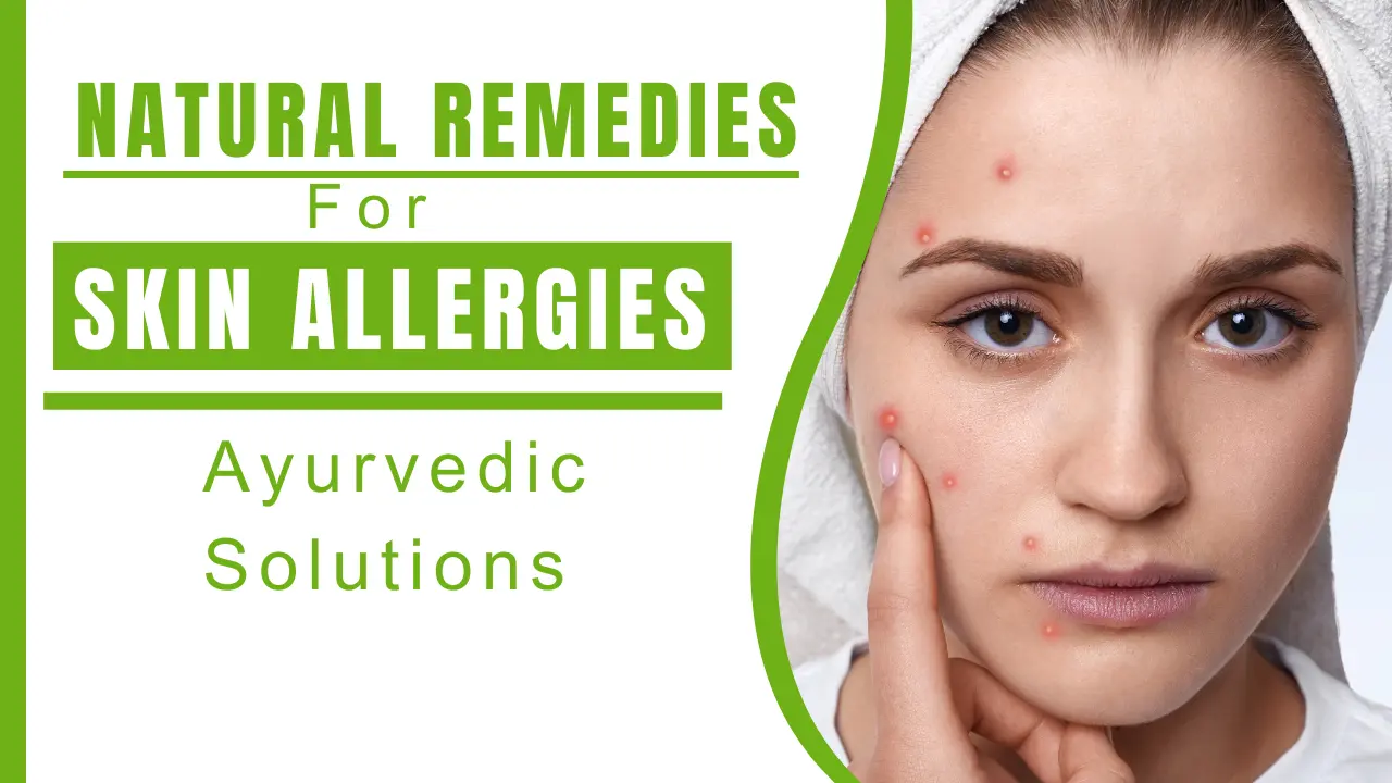 Natural Remedies for Skin Allergies_ Ayurvedic Tips and Solutions - Nirogi Healthcare