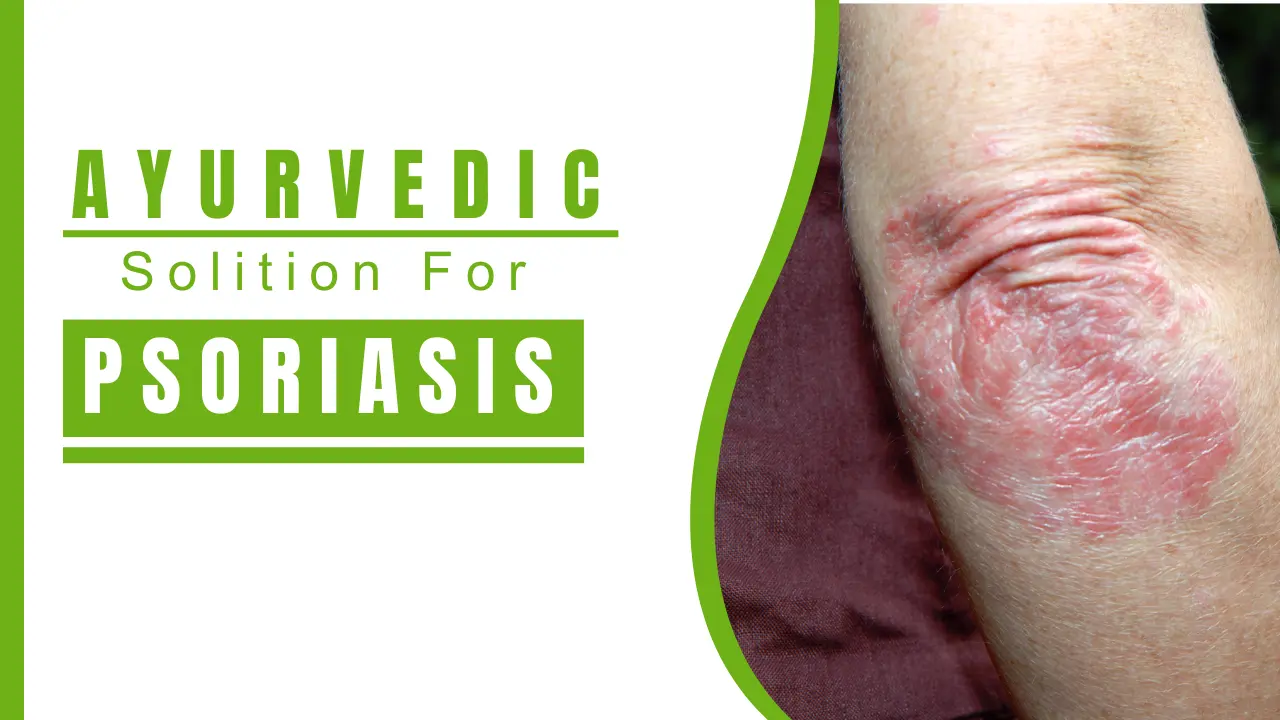 Natural Solutions for Psoriasis with Ayurveda - Nirogi Healthcare