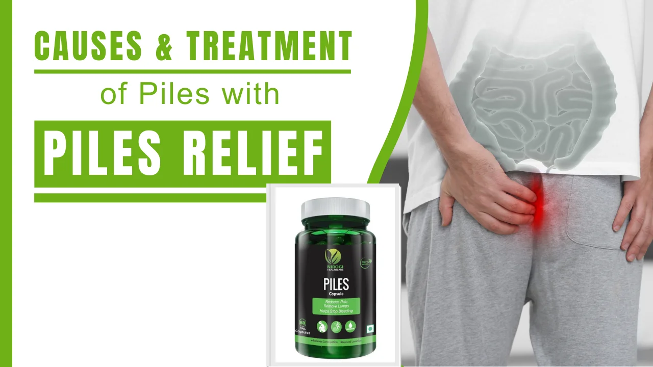 Understanding Piles_ Causes and Treatments - Nirogi Healthcare