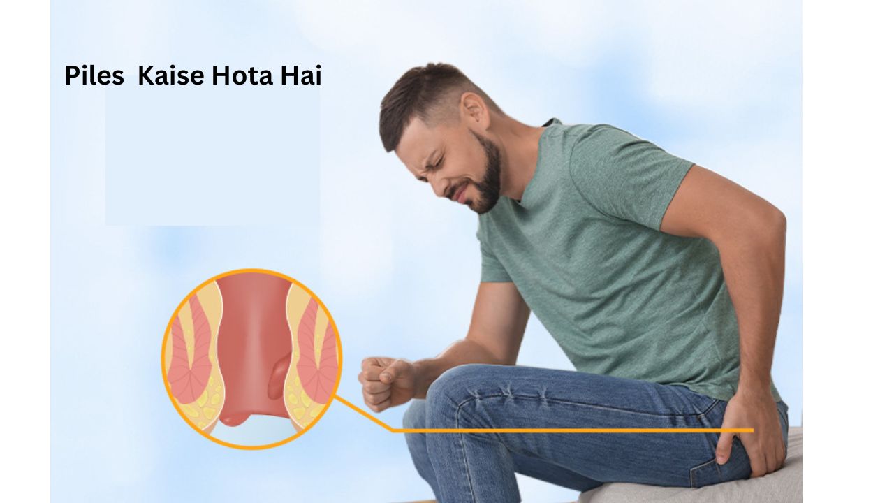 Piles Kaise Hota Hai